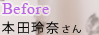 Beforeव