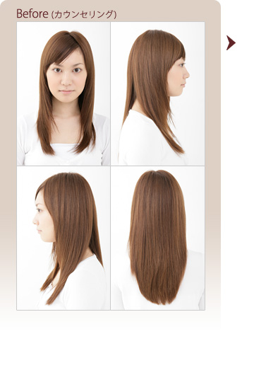 Before(カウンセリング) Before(カウンセリング)